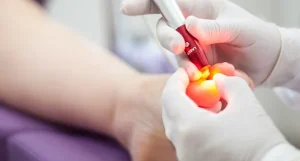 laserterapia
